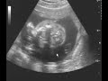 usg-cz-2.html