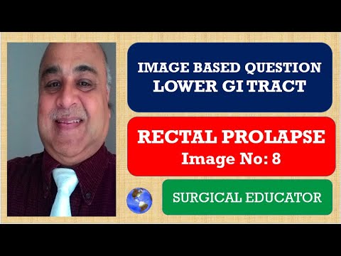 RECTAL PROLAPSE/ LOWER GI TRACT/ Image Based Questions