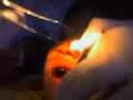 belldandy en el dentista 2