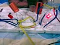 astable multivibrator 4u