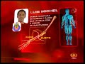 LUIS MICHEL FRACTURA CHIVAS LESION EN LA SUPERLIGA LUIS MICHEL FRACTURA CHIVAS LESION EN LA SUPERLIGA