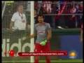 LUIS MICHEL FRACTURA CHIVAS LESION EN LA SUPERLIGA