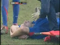 Alan Smith breaks his leg