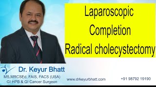 Lap Completion Radical cholecystectomy