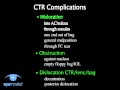 Capsular Tension Rings: Complications Phaco 3.4 Complications