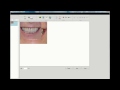 CHAIRSIDE Patient Education - Making a New Presentation
