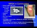 videos de MRSA
