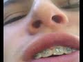 Orthodonist Orthodonist