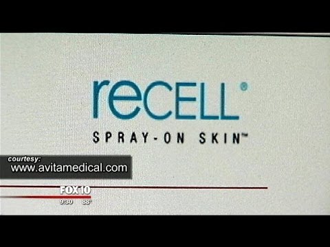 how to recover burned skin
