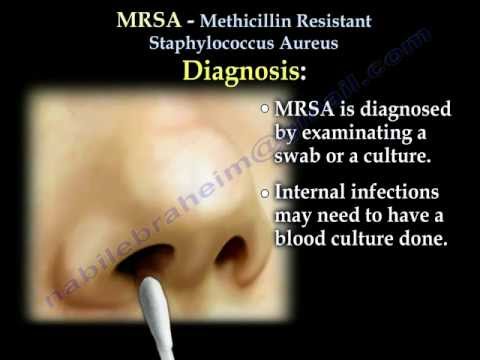 how to obtain mrsa nasal swab