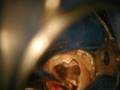PERFORATION, ENDODONTIE ,ENDONTICS ,THIERRY ROOS
