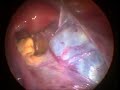 Dr. Jeronimo Amado Malincovich Especialista Laparoscopia