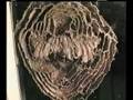 Bald-face Hornet Nest Grows Larger #3