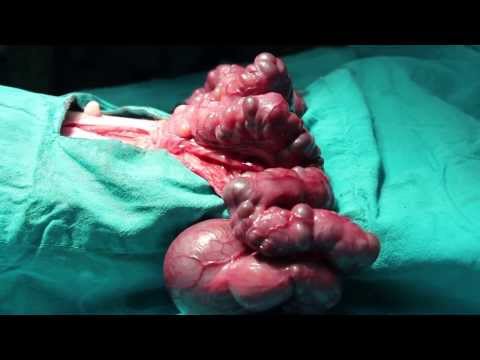 how to cure pyometra in dogs