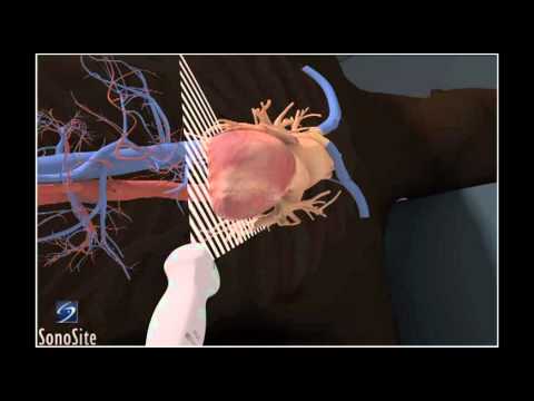 how to perform echocardiogram