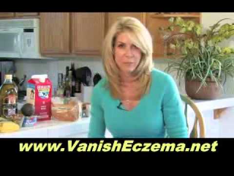 how to remove eczema