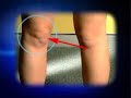 knee pain www.footkneepain.com.au