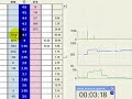 Trading Betfair Using BetAngel Pro Sat 17th Nov 2007 Trading Betfair Using BetAngel Pro Sat 17th Nov 2007