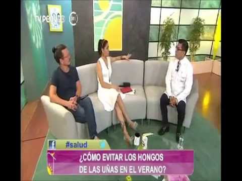 La foto varikoza después del parto