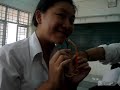 Hanh bi quay roi