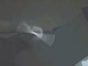 Combo chat enrag� 1st