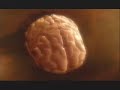 Child brain 1
