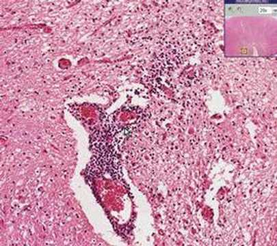 Histopathology Skeletal muscle, ...
