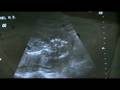 Ultrasound 2008-11-19