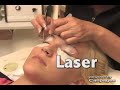 Institut Céleste Epilation Laser - (450)681-2210