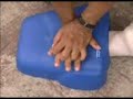 Dicas que Salvam - Parte 7 - Parada cardio-respiratória Dicas que Salvam - Parte 7 - Parada cardio-respiratória
