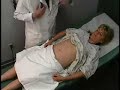 Abdomen Exam 6/8