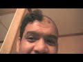 BENNY BECOMING BALD   *STRONG LANGUAGE*