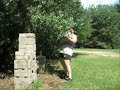 Conquering the Hernia Stone