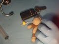 rianimazione rcp con adrenalina e defibrillatore