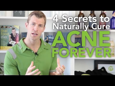 how to cure hormonal acne naturally