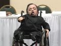 Sean speaking (Part 1) Osteogenesis imperfecta, type I