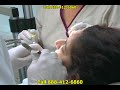 simple-molar-wisdom-tooth-extraction.html