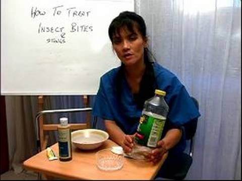 how to treat bug bites
