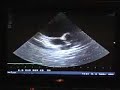 Anagachie Echocardiogram