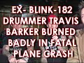EX- BLINK 182 TRAVIS BARKER BADLY BURNED AND ALMOST KILLED IN PLANE CRASH