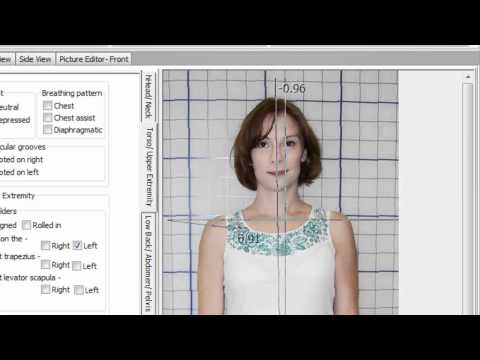 how to assess posture