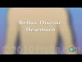 PreOp® Patient Education Anti-Reflux Laparoscopy Surgery 2