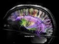 New Discoveries in Brain Structure and Connectivity