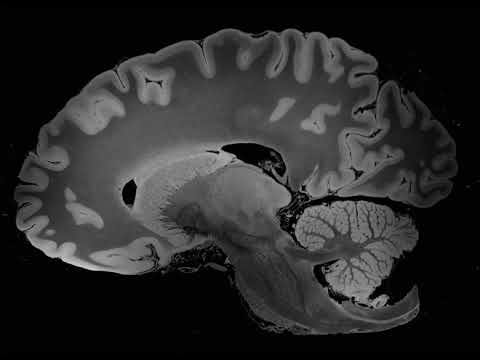 Resonancia magnética capturó la imagen más detallada del cerebro humano (ING)