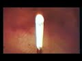 The Louvin Brothers - Great Atomic Power