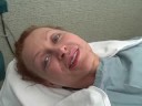 David Rahimi, MD Forever Young Tuliplift Patient Barbara