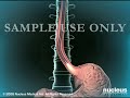 3D Medical Animation Upper GI Endoscopy 3D Medical Animation Upper GI Endoscopy