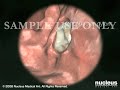 3D-Medical-Animation