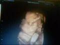 25 week 3D/4D Ultrasound Scan