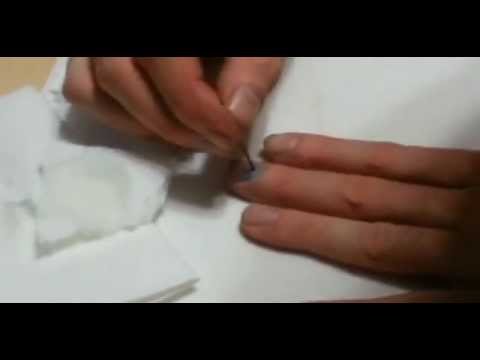 how to fix jammed finger